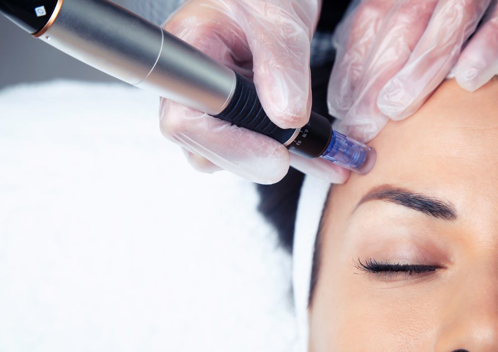 Shot,Of,Cosmetologist,Making,Mesotherapy,Injection,With,Dermapen,On,Face